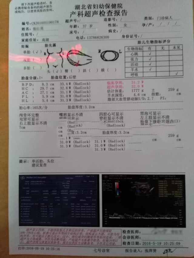 广州代妈