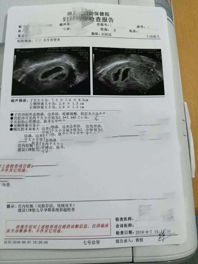 广州代妈