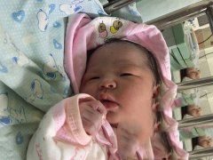 35岁卵巢巧克力囊肿试管成功怀孕